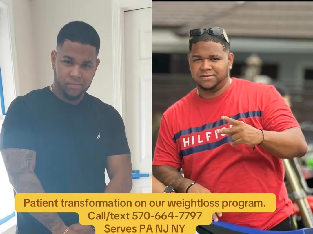 Male patient transformation on our medical weight loss program
