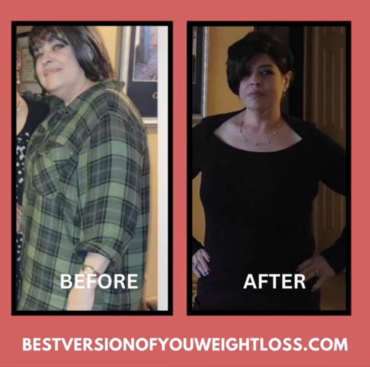 Patient before and after losing weight with GLP-1 therapy