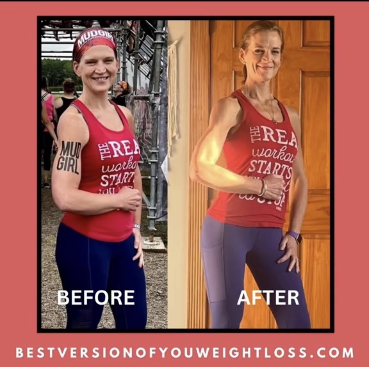 Active patient before and after body recomposition