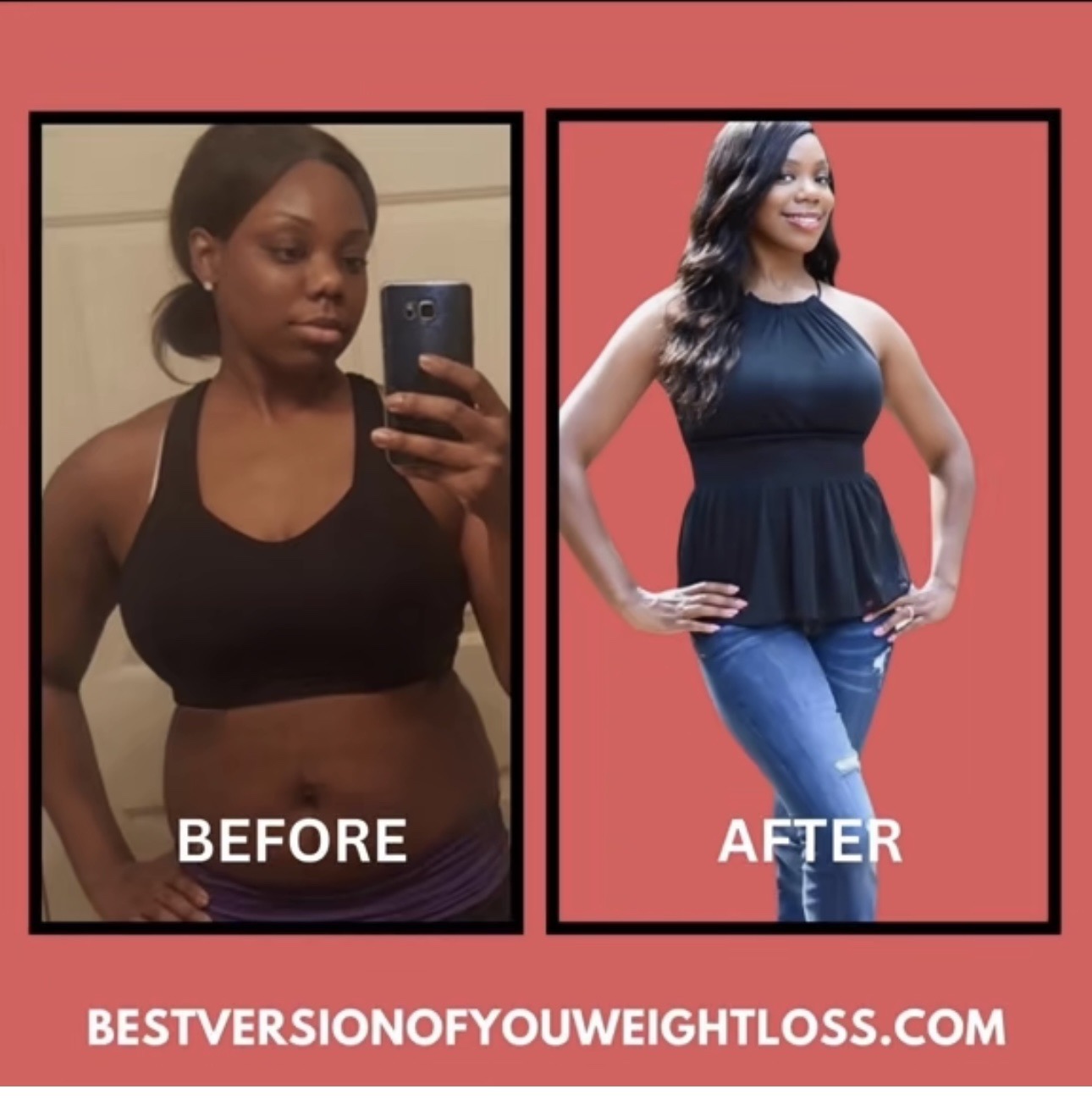 Patient before and after medical weight loss program