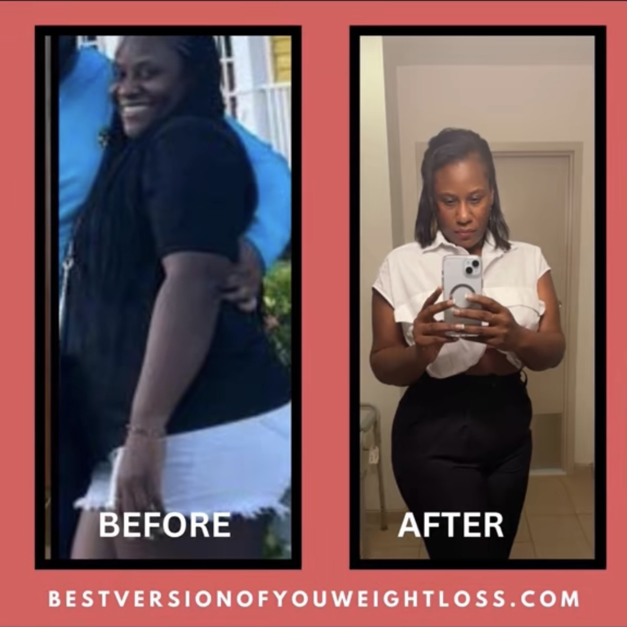 Patient before and after medically supervised weight loss